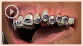 Orthodontics